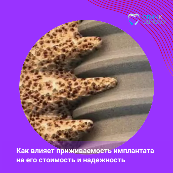 Приживаемость импланта. Клиническим опытом делится имплантолог пермской стоматологии "Один к Одному"