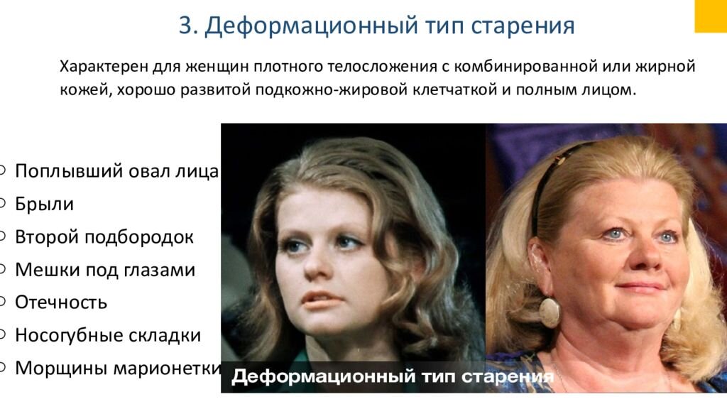 Деформационный тип старения примеры