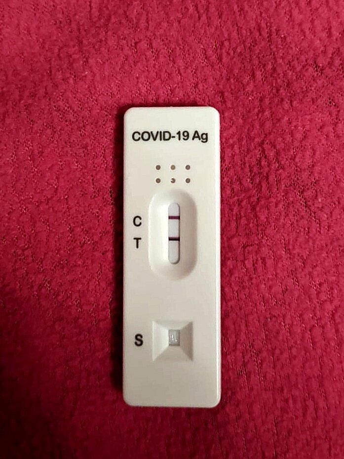 Экспресс тест на COVID-19