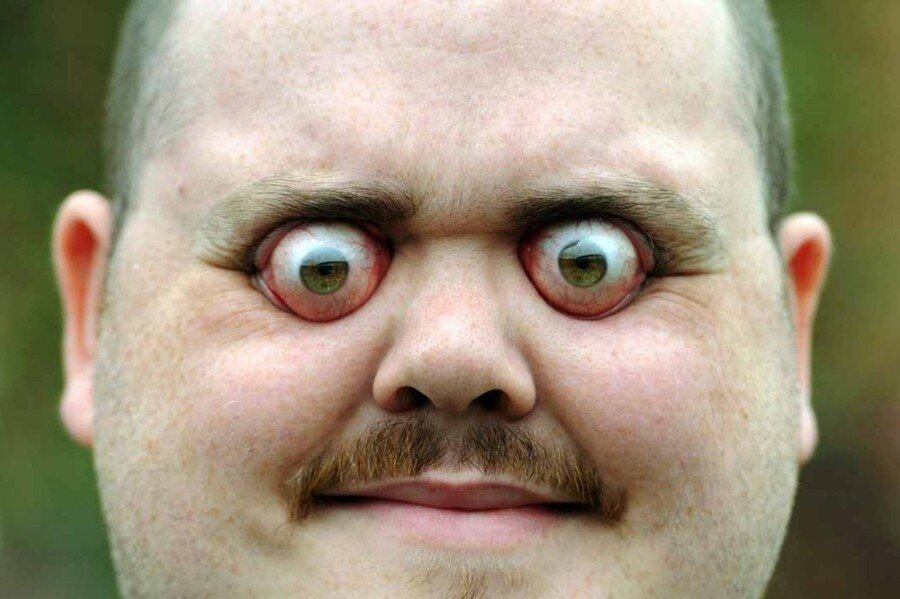 Выпученные!