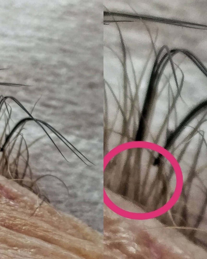 СПУСТЯ 10 ДНЕЙ...