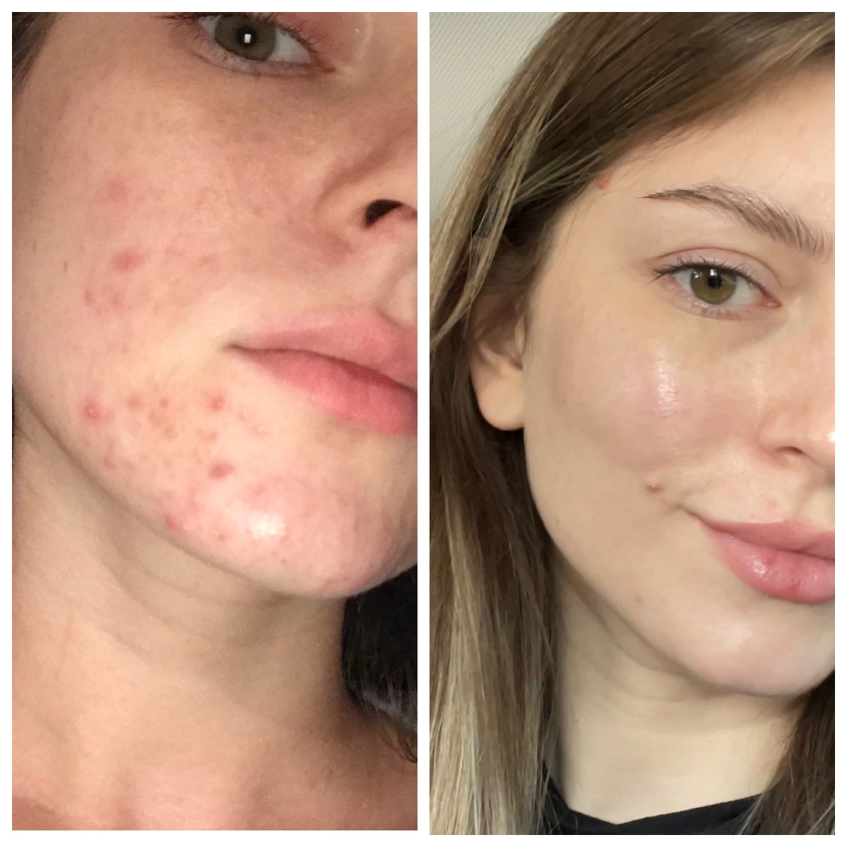 Мое до/после