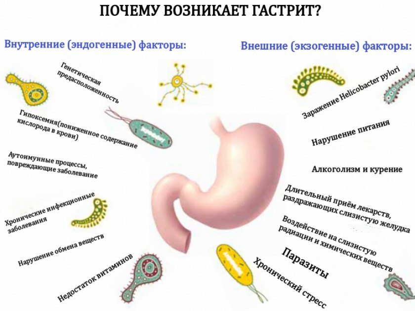 Облепиховое масло при гастрите язве. Облепиховое масло для желудка при гастрите. Факторы гастрита. Облепиховое масло для желудка при гастрите и язве.