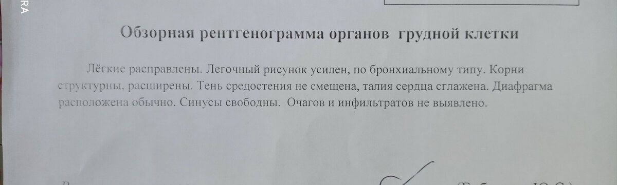 Мой рентген