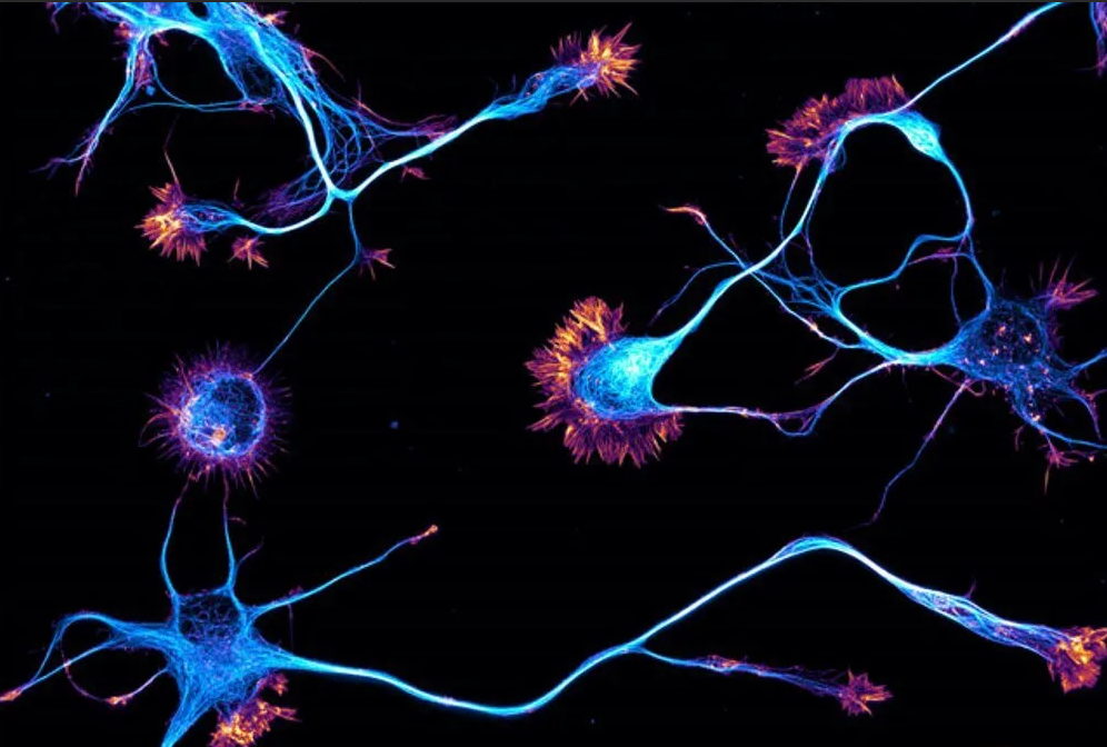 Нервные клетки