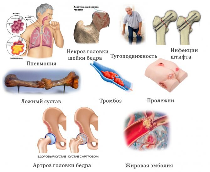 Какие структуры могут пострадать при ушибе?