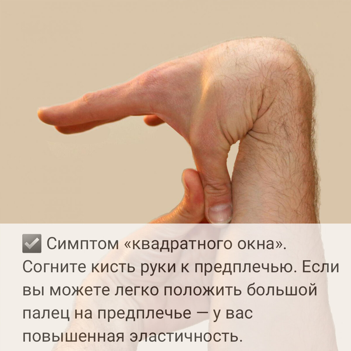 Симптом «квадратного окна»