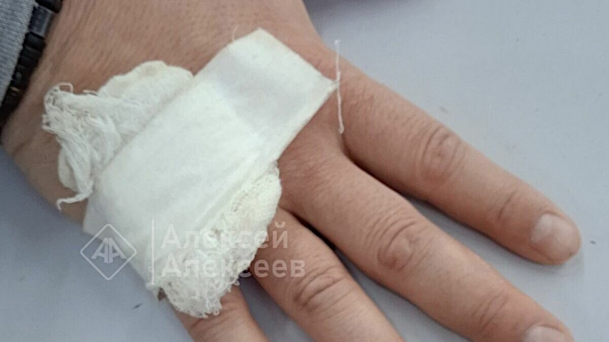     Бродячая собака покусала человека в парке «Утиное озеро» в Дзержинске. Об этом сообщает местный житель Алексей Алексеев.