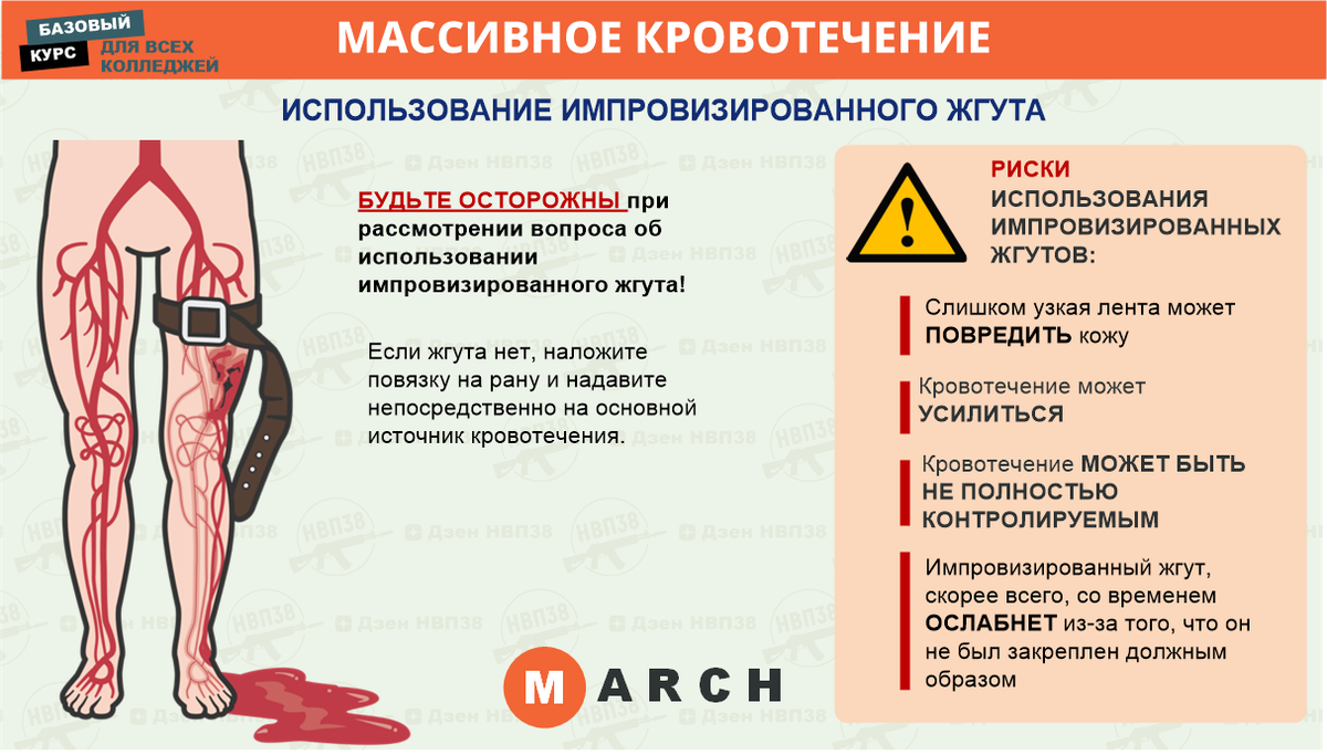 Тактическая медицина. Базовый курс. 2 часть. | НВП38 | Дзен