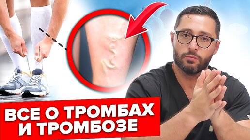 Descargar video: Реальные причины и последствия тромбоза. Как избежать и лечить?