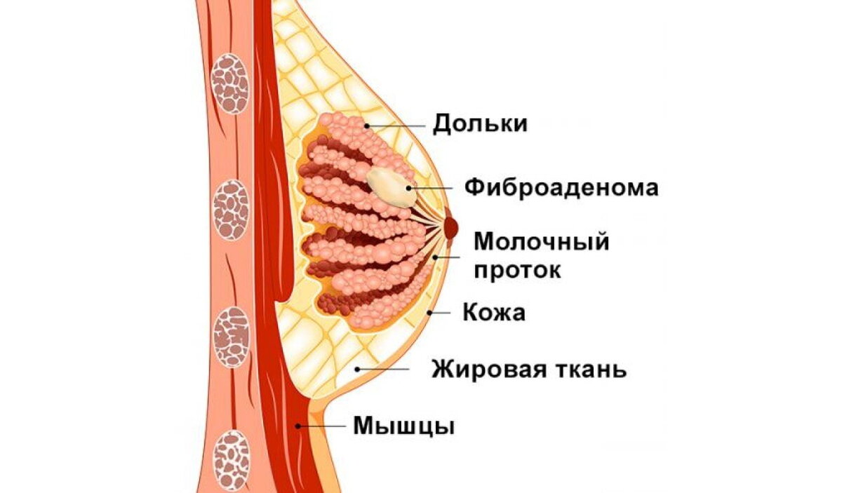 Фиброаденома психосоматика