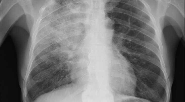   Atlas of Pulmonary Pathology / Flickr