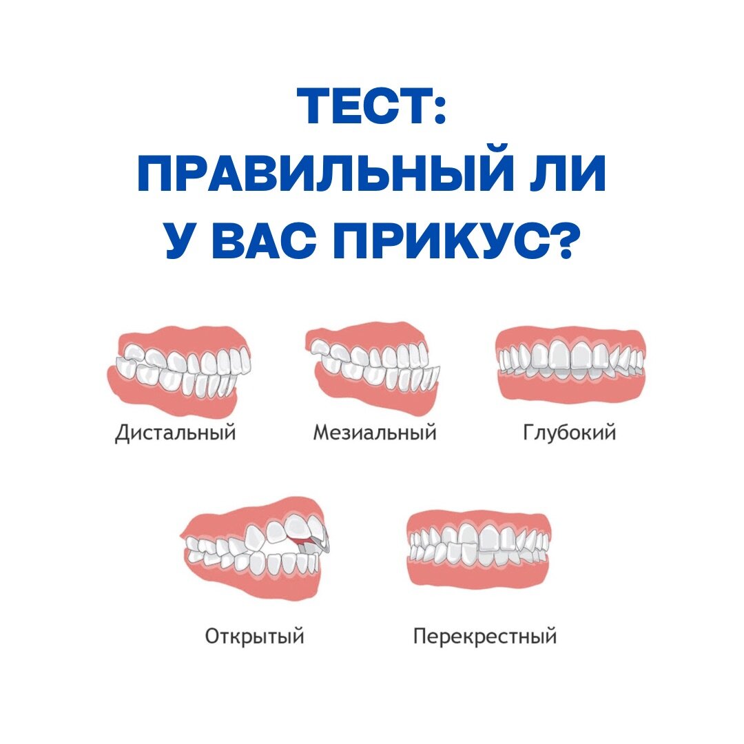 Как отличить правильный и неправильный прикус?