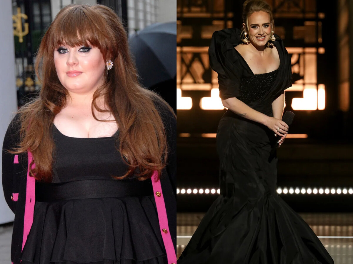 #plasticsurgery #beforeandafter #celebrities #celebrity #adele #fashion #Plastic