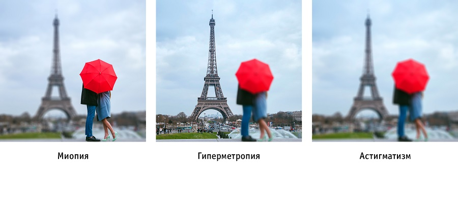 Примеры нарушения зрения