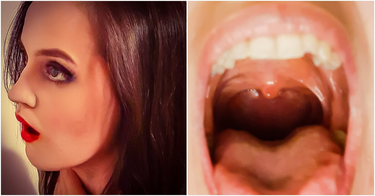 Вокальное "чрево" - гортань