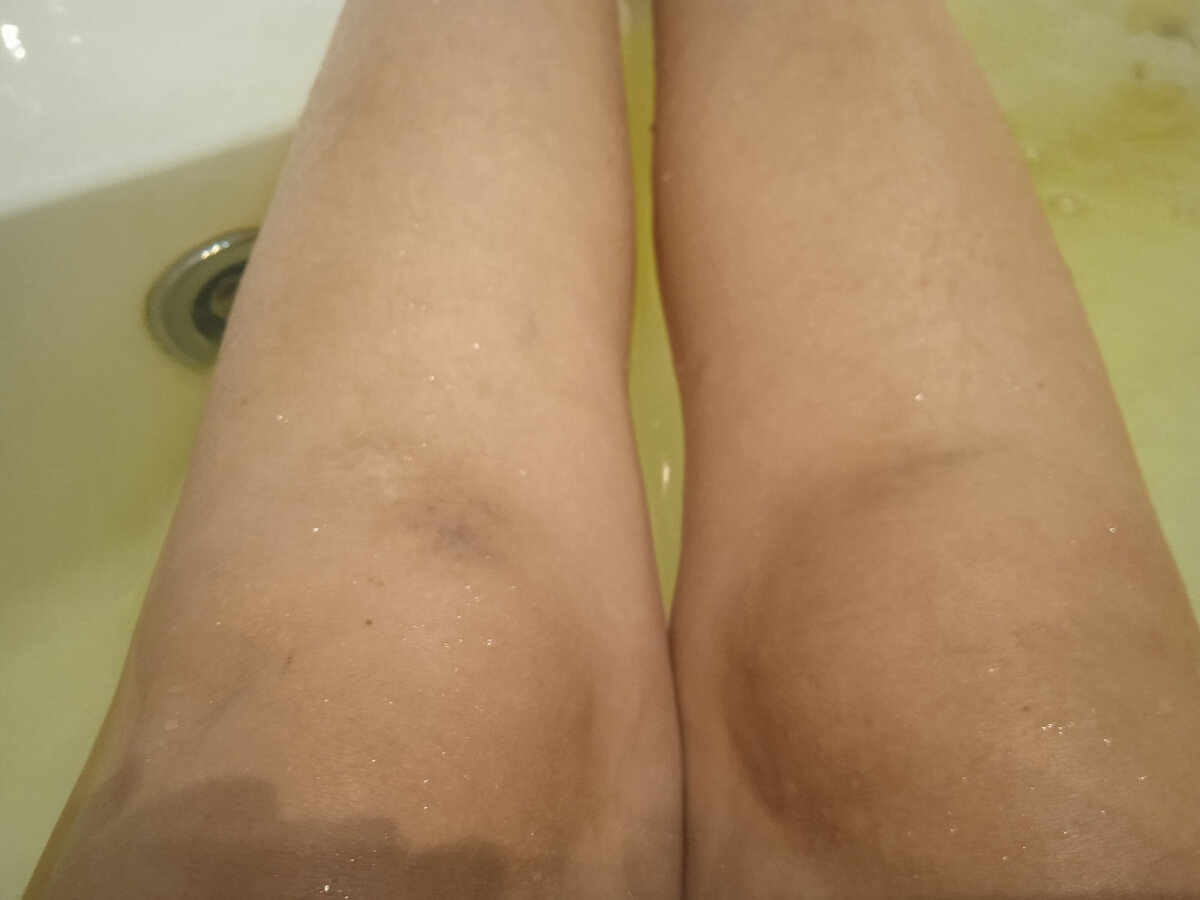 Парашютный спорт сопряжëн с риском для жизни и здоровья. Синяки вот можно набить. Фото автора, колени автора) 