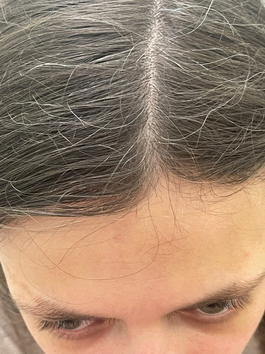 Почему седеют волосы и как отсрочить этот процесс