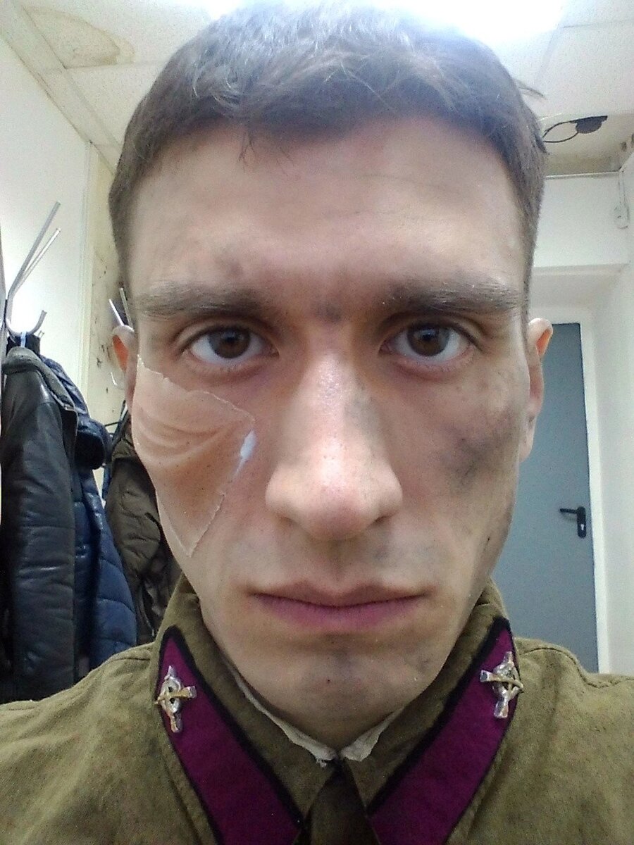 Первые накладки приклеиваются. По сути это желе под цвет кожи. 