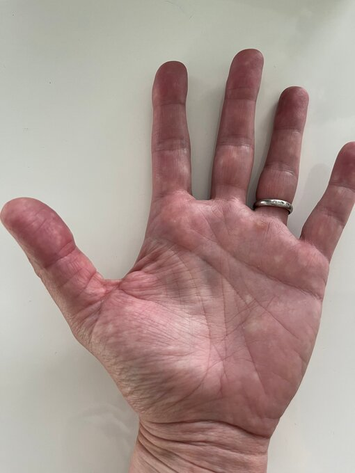 Левая рука.