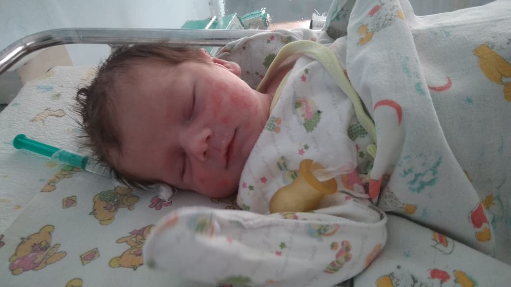 Дим Димыч, первая встреча, на щечках реакция на антибиотики 