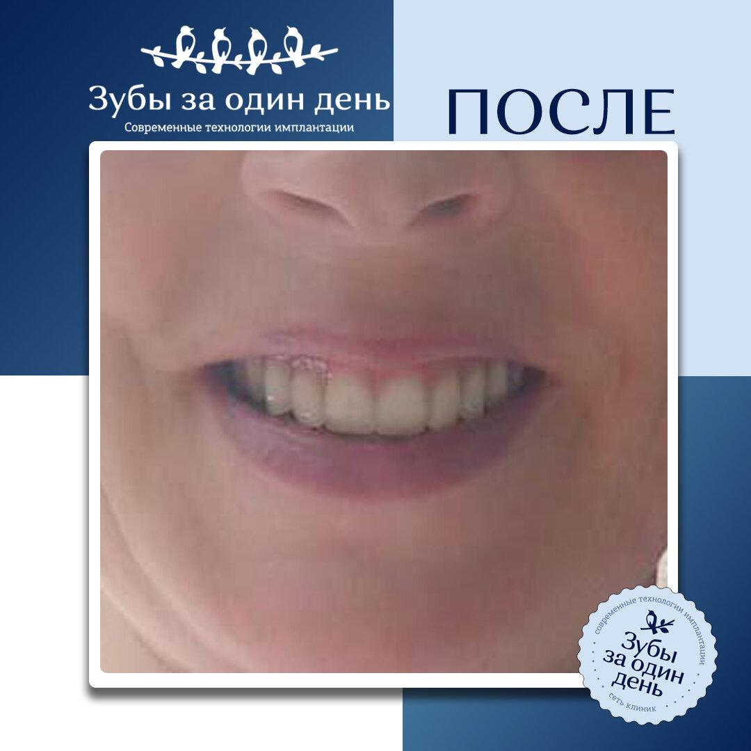 фото сети клиник "Зубы за 1 день"