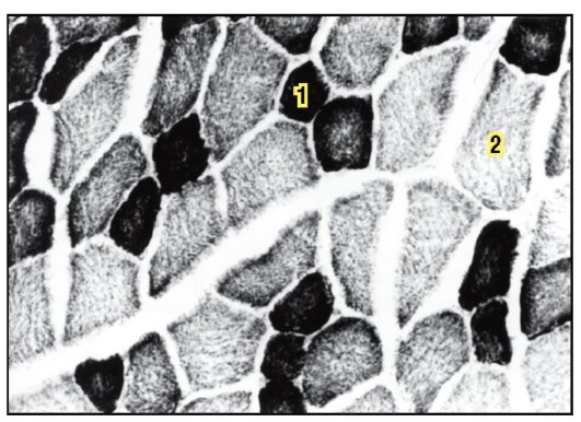  Рис. 1. Поперечный срез скелетной мышцы с разными типами волокон (из открытых источников с изменениями): 1- красные (медленные, окислительные) мышечные волокна
2 - белые (быстрые, гликолитические) мышечные волокна


