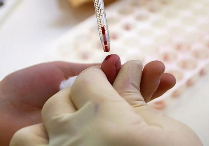 
Кровь чаще всего берут из безымянного пальца потому, что, по сравнению с указательным и средним, он меньше используется в работе. Кожа на нём тоньше, и прокол получается менее болезненным. 

Мизинец же не используется из-за того, что он, как и большой палец, напрямую соединён с оболочками кисти. Если через них занести инфекцию, она может быстро распространиться на всю руку.