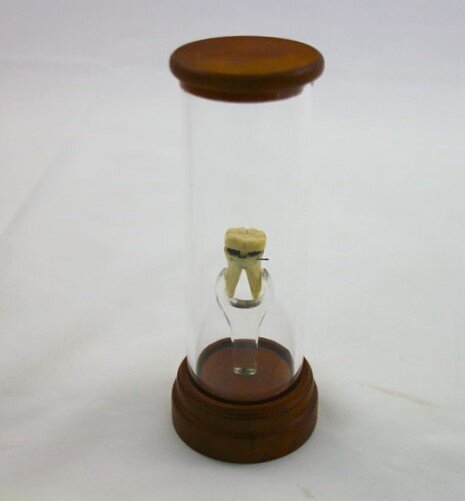 Пример такого гипотетического зуба в музее / Источник: Atlas Obscura 