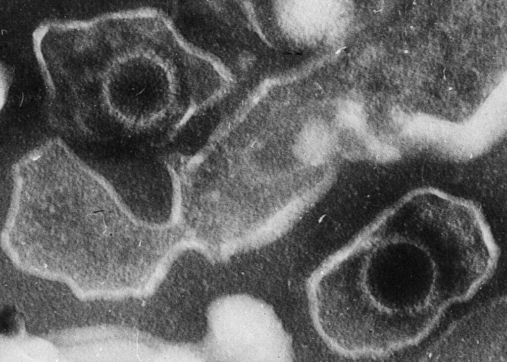 Вирионы вируса. Капсиды – круглые защитные белковые оболочки, свободно окруженные мембраной. Фото: wikipedia.org