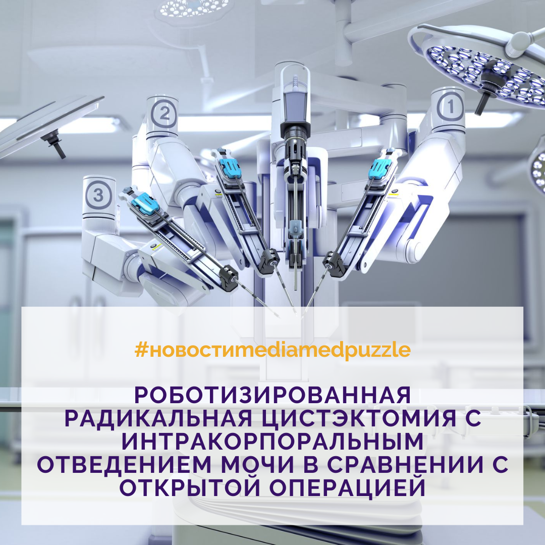 Роботизированная радикальная цистэктомия с интракорпоральным отведением мочи  в сравнении с открытой операцией | Media Puzzle | Дзен