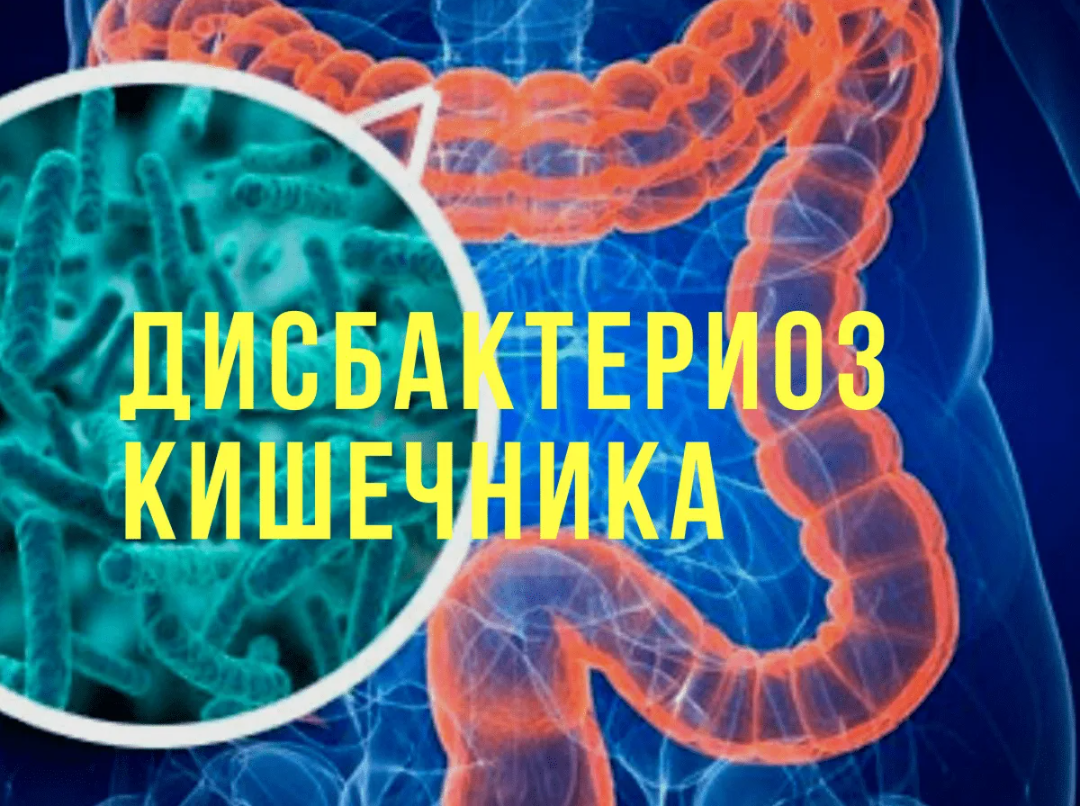 Дисбактериоз кишечника: симптомы у взрослых, лечение по низким ценам в СПБ, отзывы