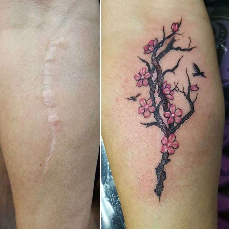 Татуировки для девушек на шрам рука