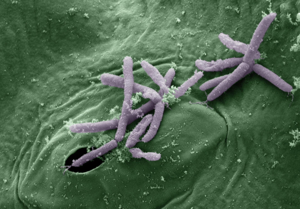 Бактерии которые есть в человеке. Сиреневый псевдомонас. Pseudomonas syringae. Псеудомонас бактерия.