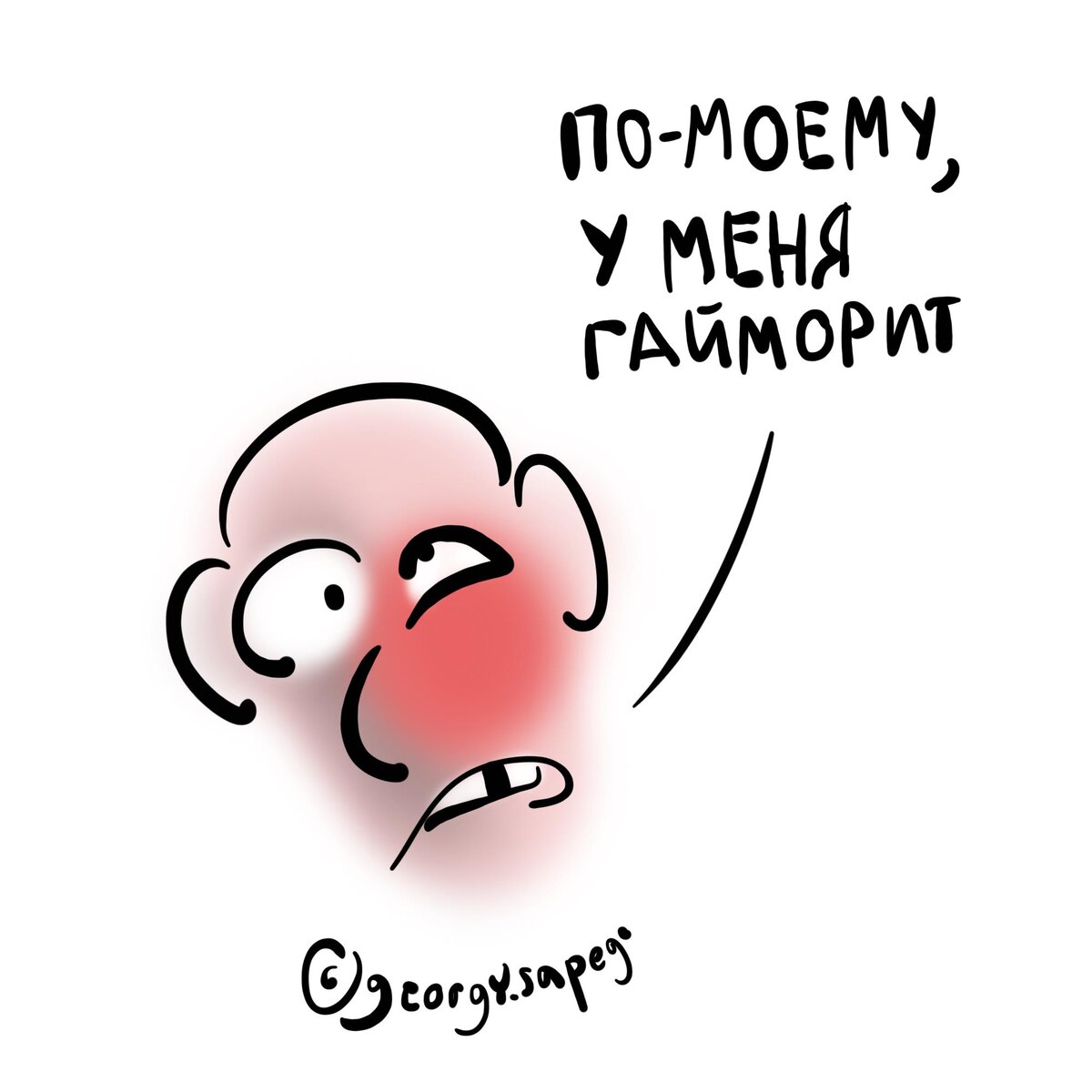 Какая причина у гайморита | Для пациентов | Дзен