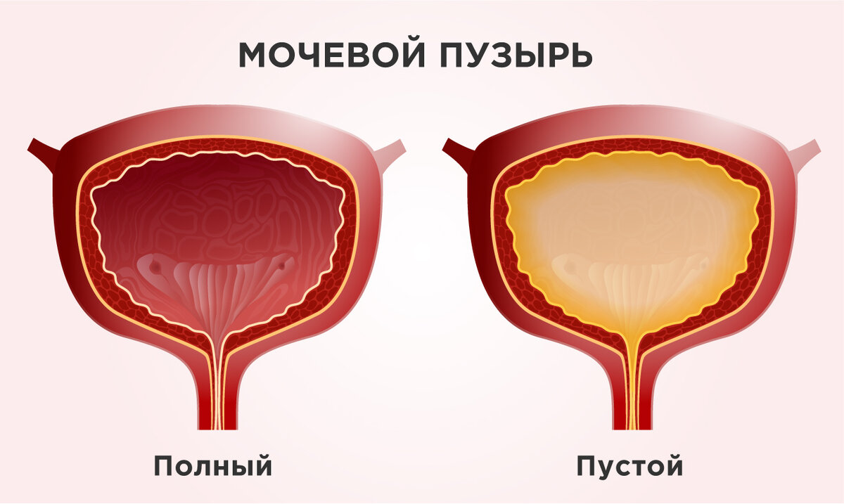 Держите — не держите: как лечить недержание мочи у женщин? | Москва —  столица здоровья | Дзен