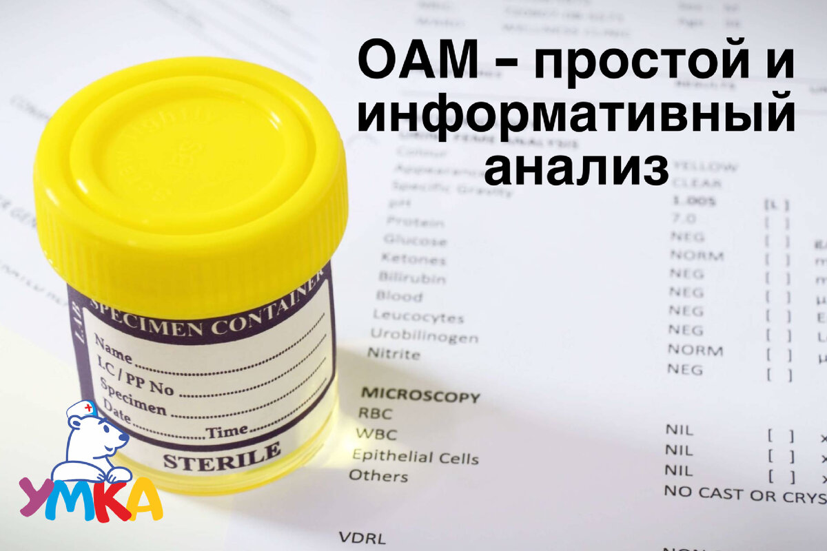 Сколько хранится моча на анализ. Общий анализ мочи картинки.
