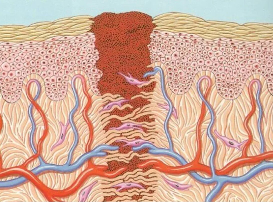 Заживление раны после. Заживление РАН гистология. Регенерация тканей. Регенерация эпителия кожи.