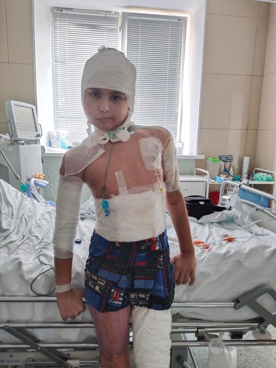     Следующая операция состоится летом, но она будет не последней. Фото: предоставлено мамой мальчика Ириной