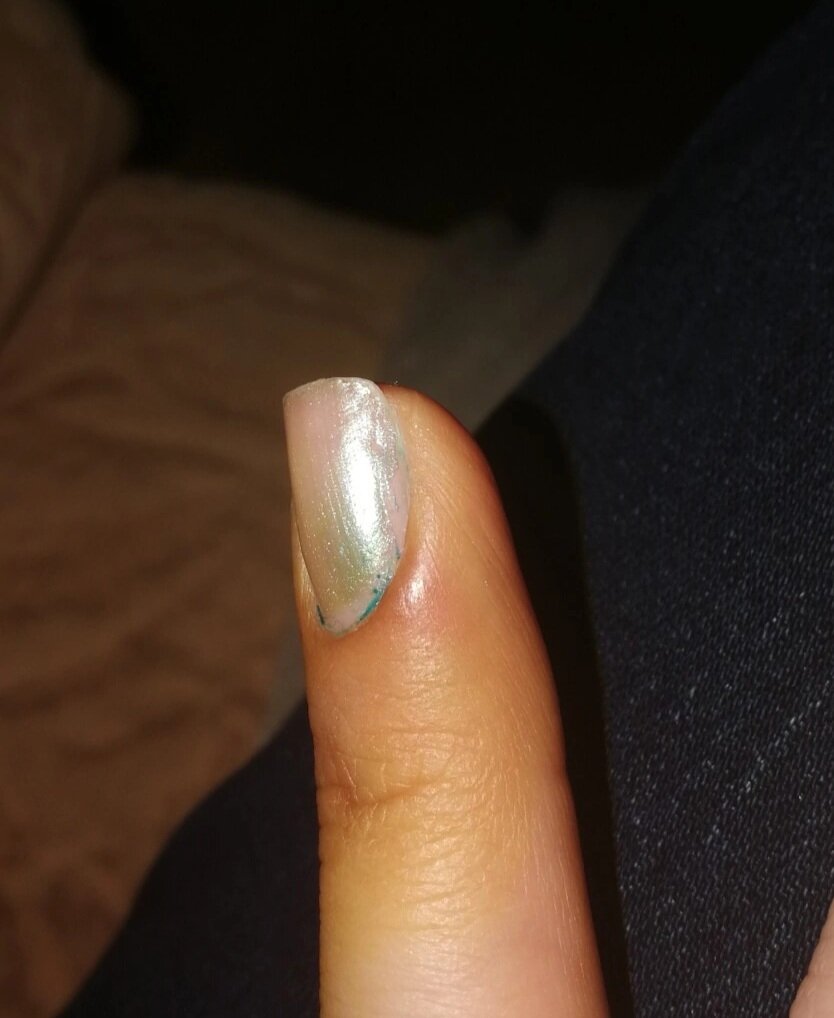 Мой многострадальный палец в йоде, который я, как Данко сердце, носила впереди себя и ждала, что меня пожалеют и успокоят, что ничего не будет)