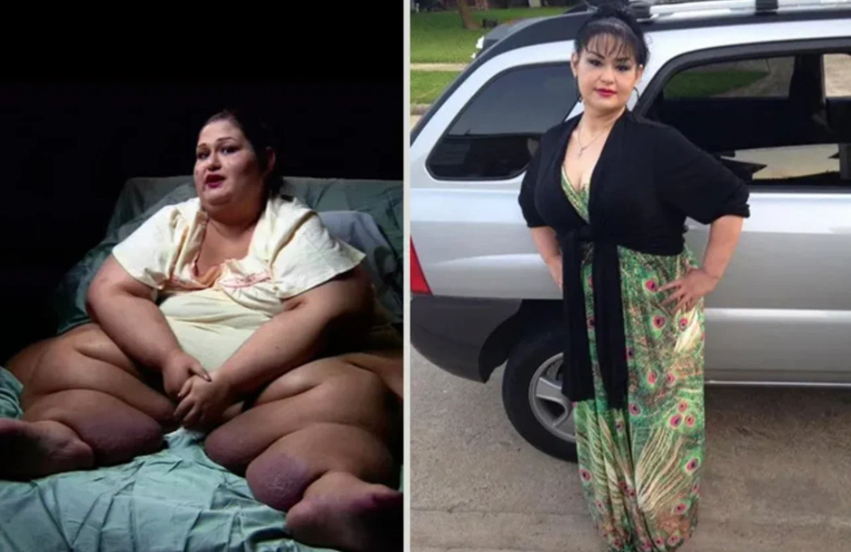 Майра Росалес родилась в 1980 году. Сейчас ей 42 года она счастливо живет со своим мужем обычной семейной жизнью. И если не знать ее историю, сложно подумать, что когда-то ее вес достигал 470 кг, и она официально носила титул самой тяжелой женщины в мире из ныне живущих.