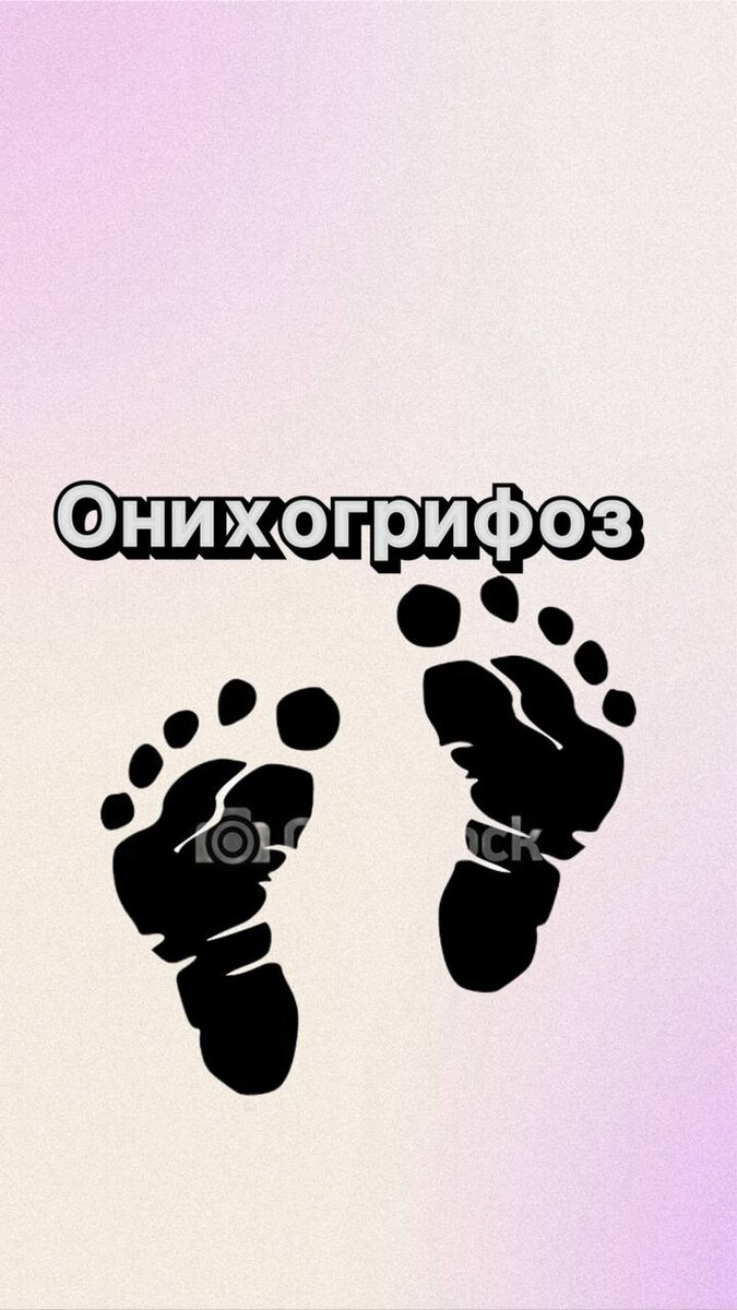 Онихогрифоз является серьезной проблемой как в эстетическом плане, так и с медицинской точки зрения.