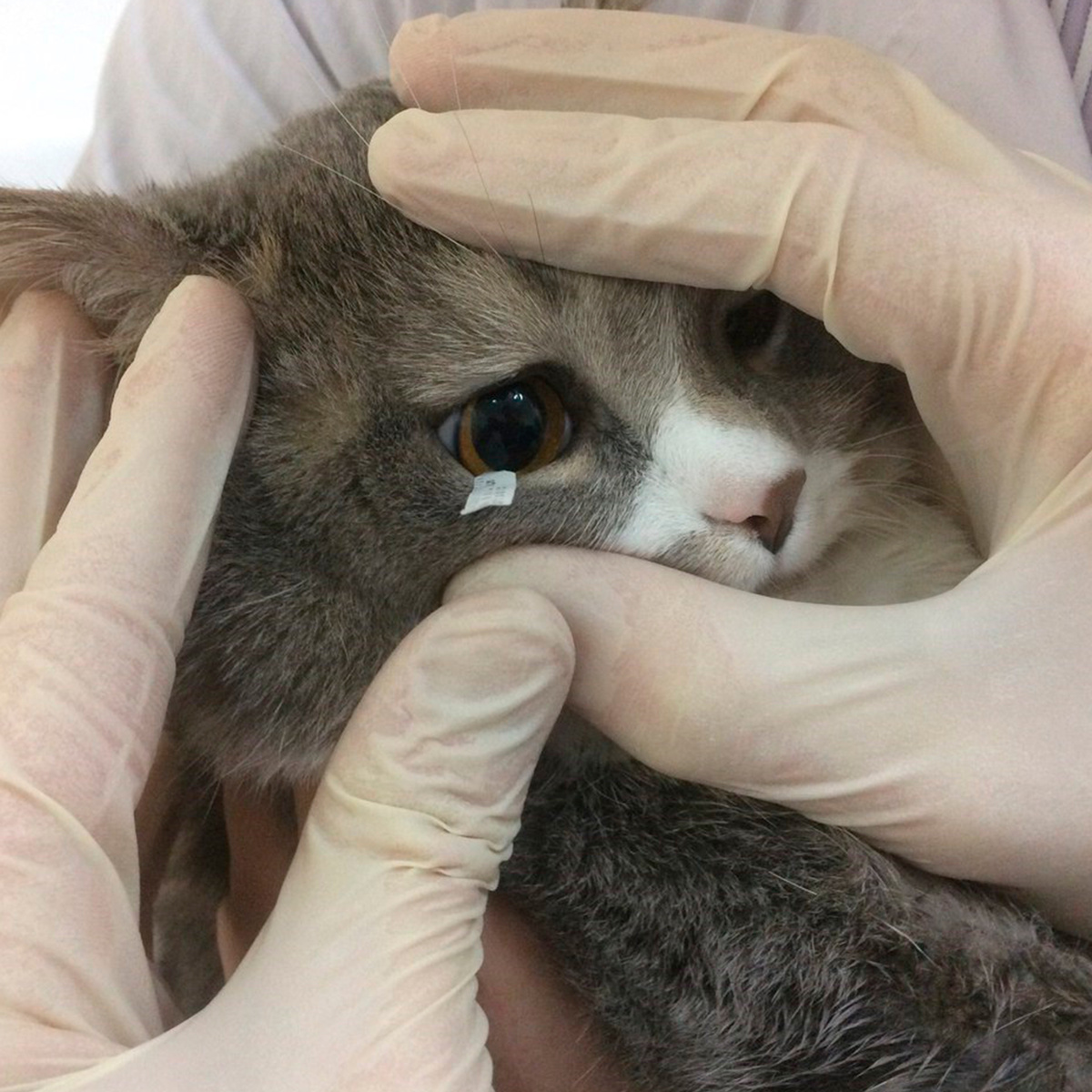 Тест ширмера