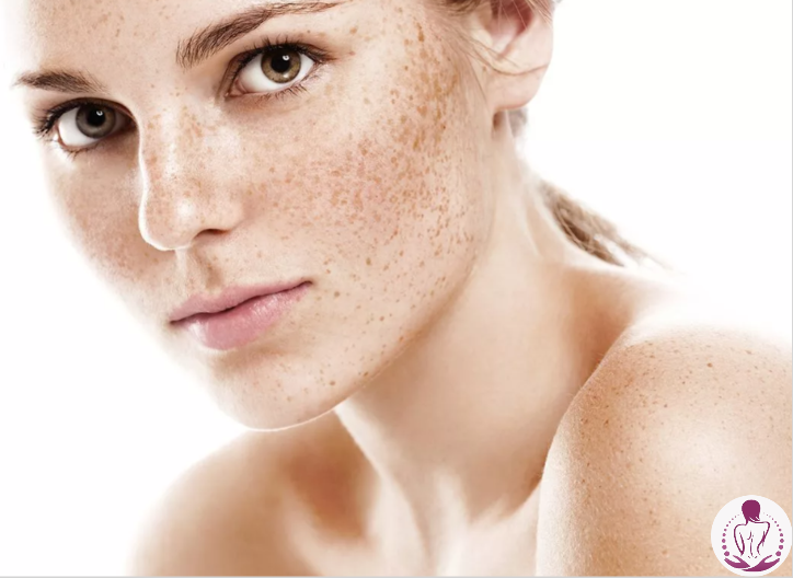Пигментация: веснушки, мелазма, старческие пятна. Причины появления и методы устранения.