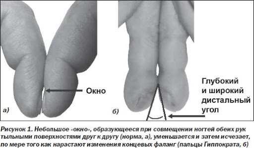 Похожие и рекомендуемые вопросы