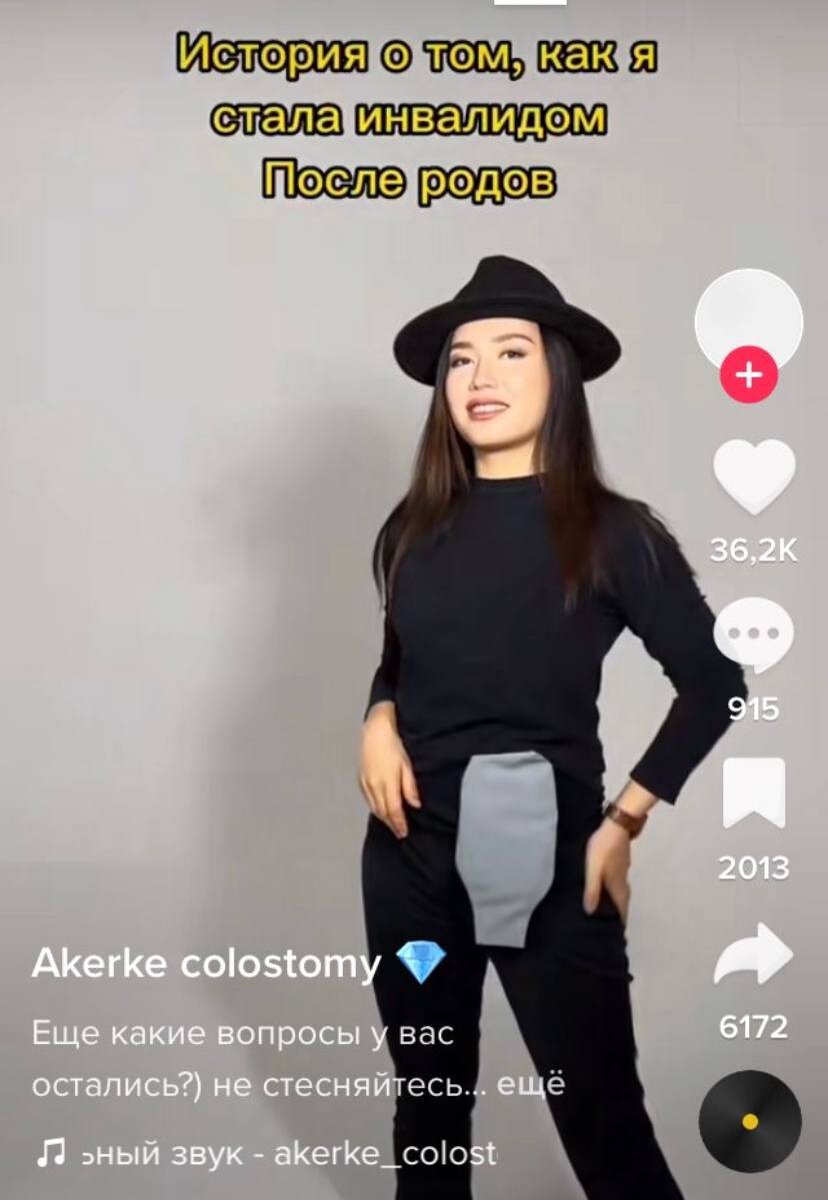 После родов стала инвалидом: блогер рассказала про ужасное осложнение ...