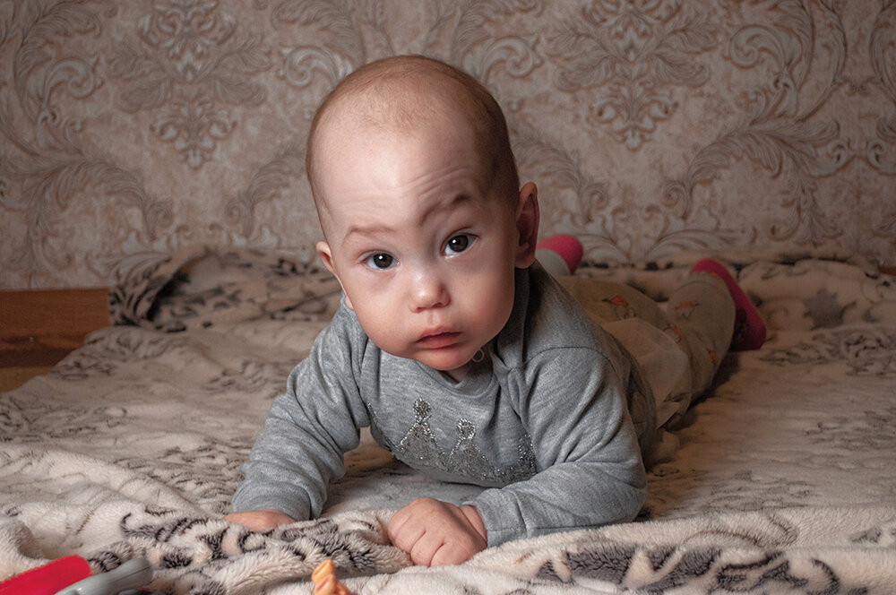 Полина Кузьмина до операции (Фото: личный архив)