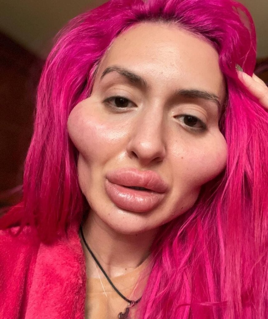 -2