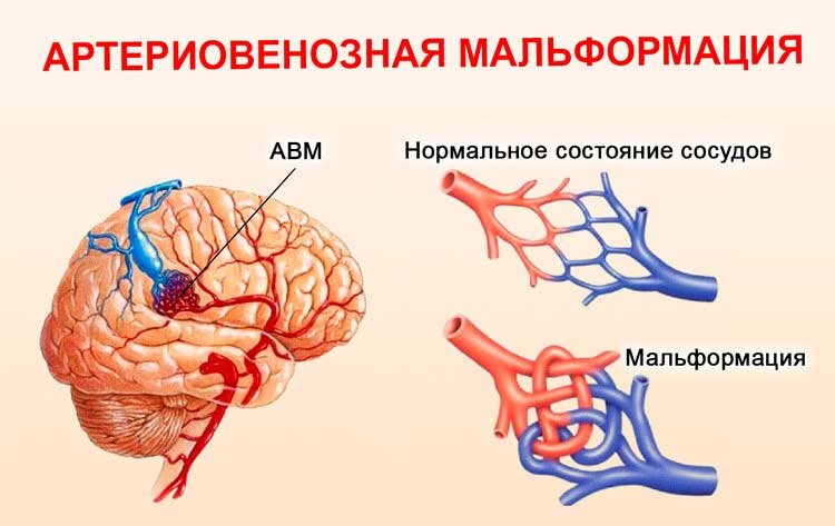 «Le mal de mer». Что означает приставка «МАЛЬ-» в медицине?