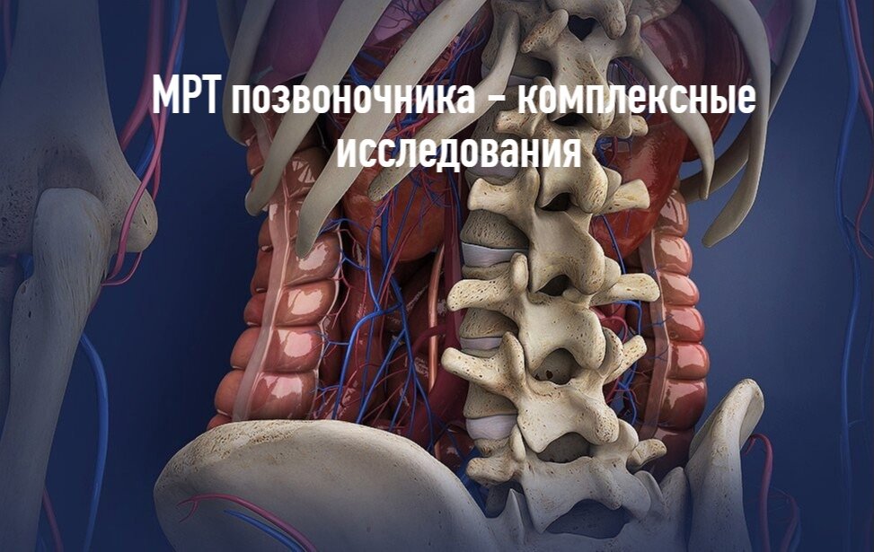 МРТ позвоночника - комплексные исследования